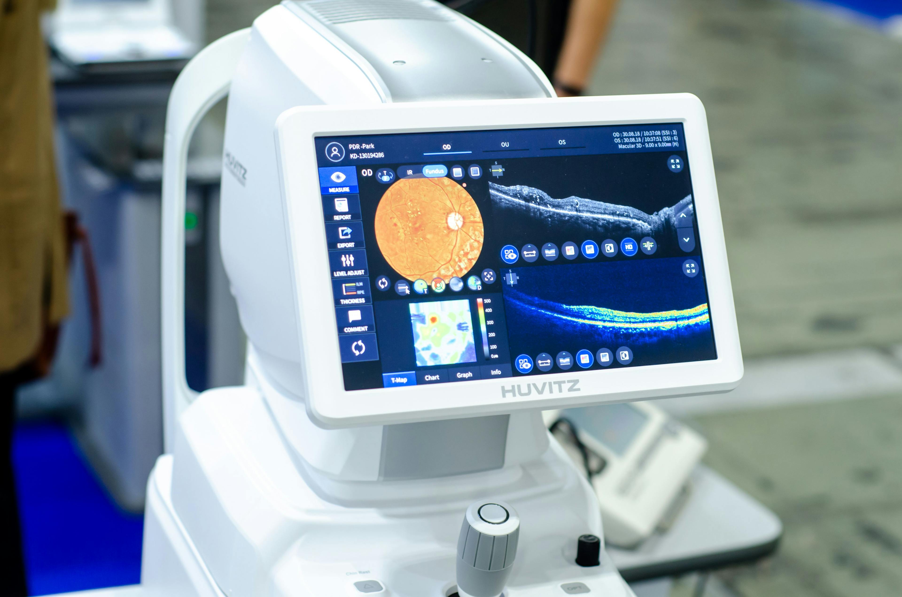 Optical Coherence Tomography Machine | Image Credit: Олександр Луценко/Adobe Stock
