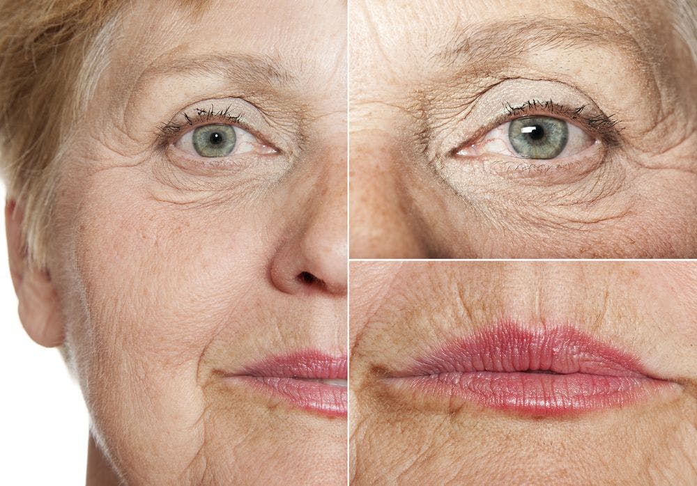 Farnesol-containing facial masks may improve UVB-exposed skin