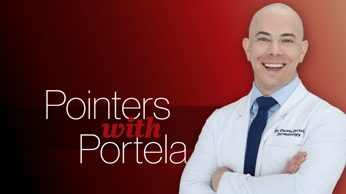 Pointers With Portela: Tackling Blackheads and Whiteheads