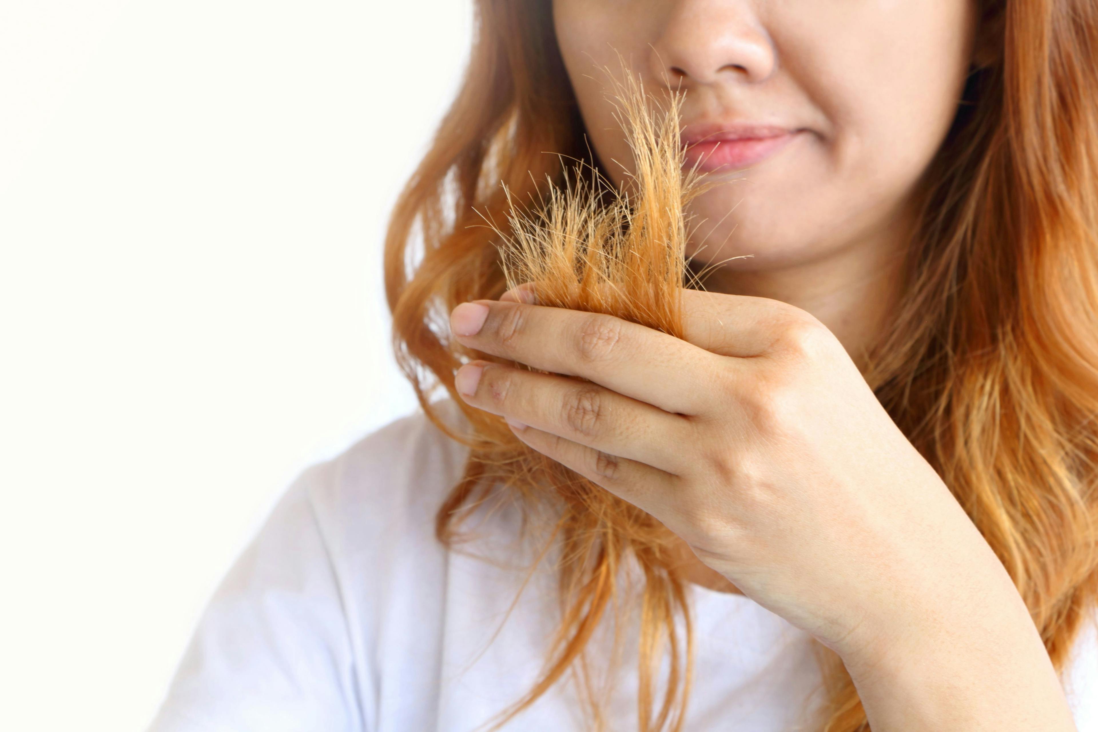 Hair Today, Gone Tomorrow: Consulting Patients on Preventing Hair Breakage