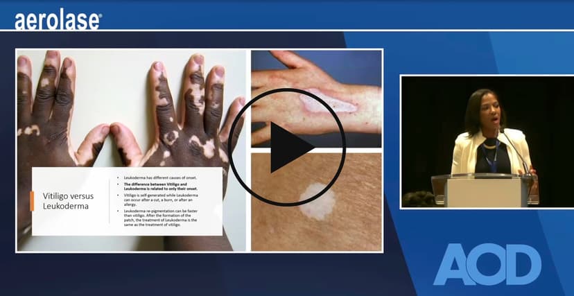 Innovations in Treating Vitiligo and Leukoderma with Cheryl Burgess, MD