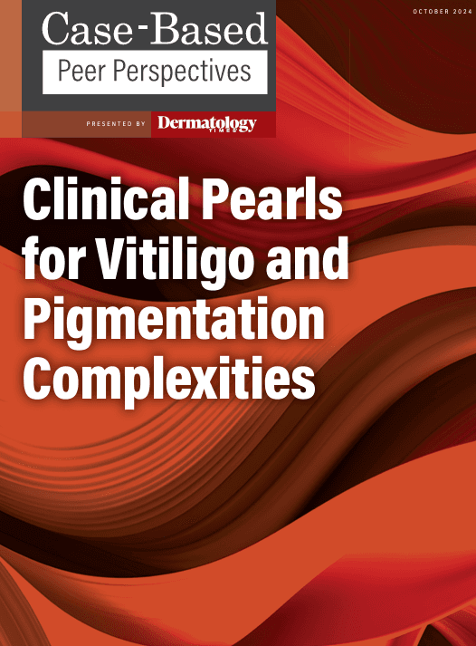 Clinical Pearls for Vitiligo and Pigmentation Complexities: Part 1