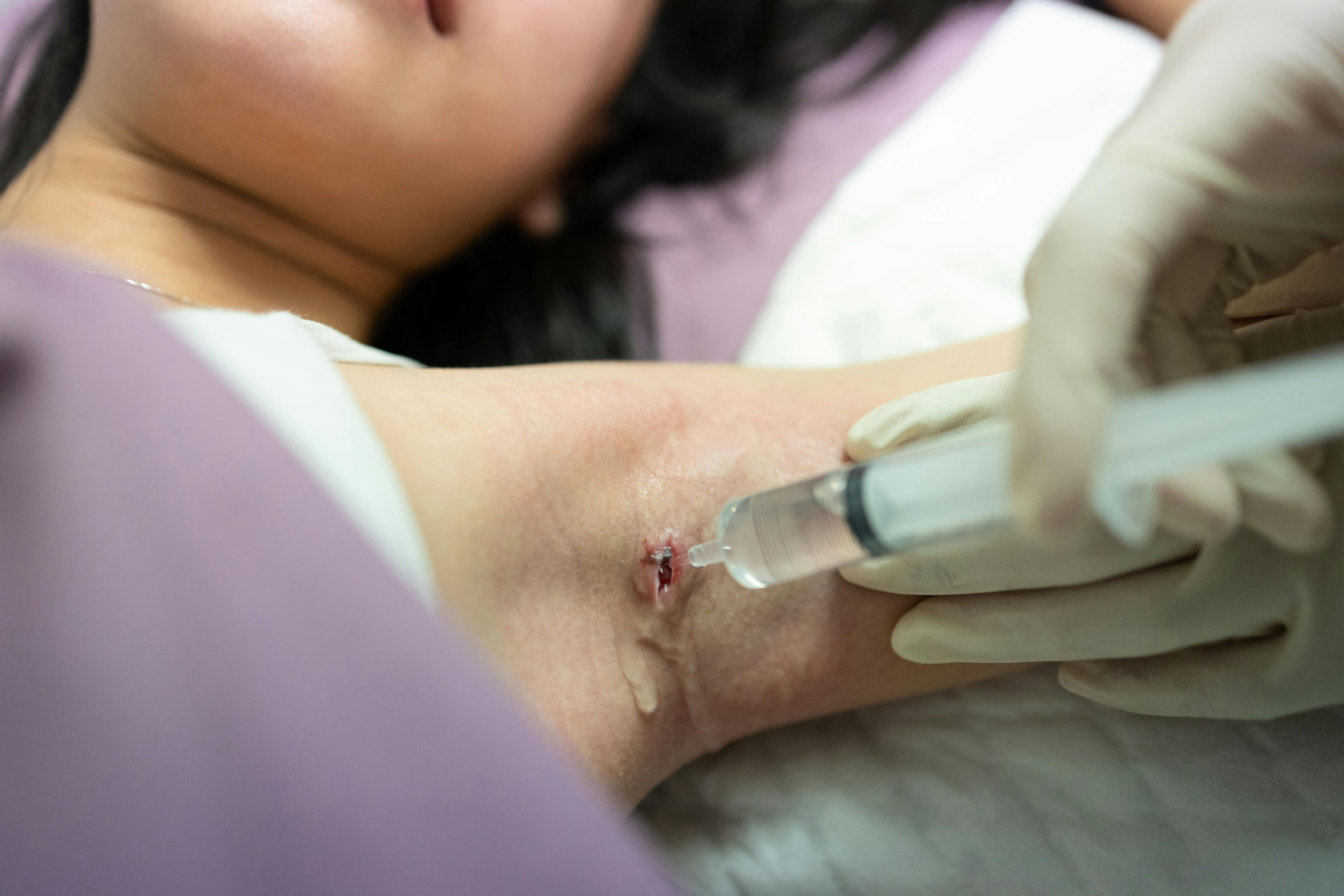 Rapid HS Pearls: Drug Data and Wound Care