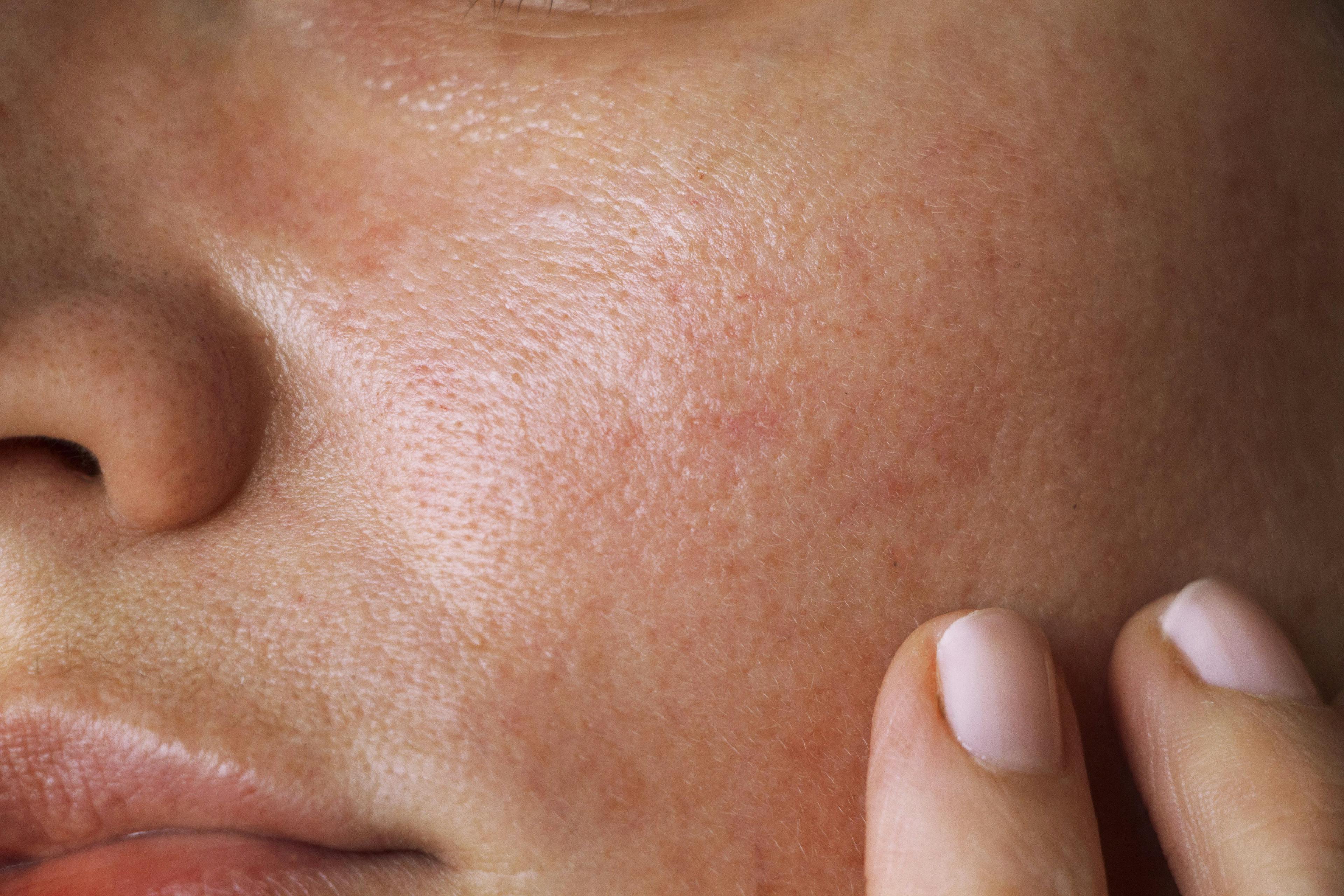 Up close view of woman's skin, pores on the cheek