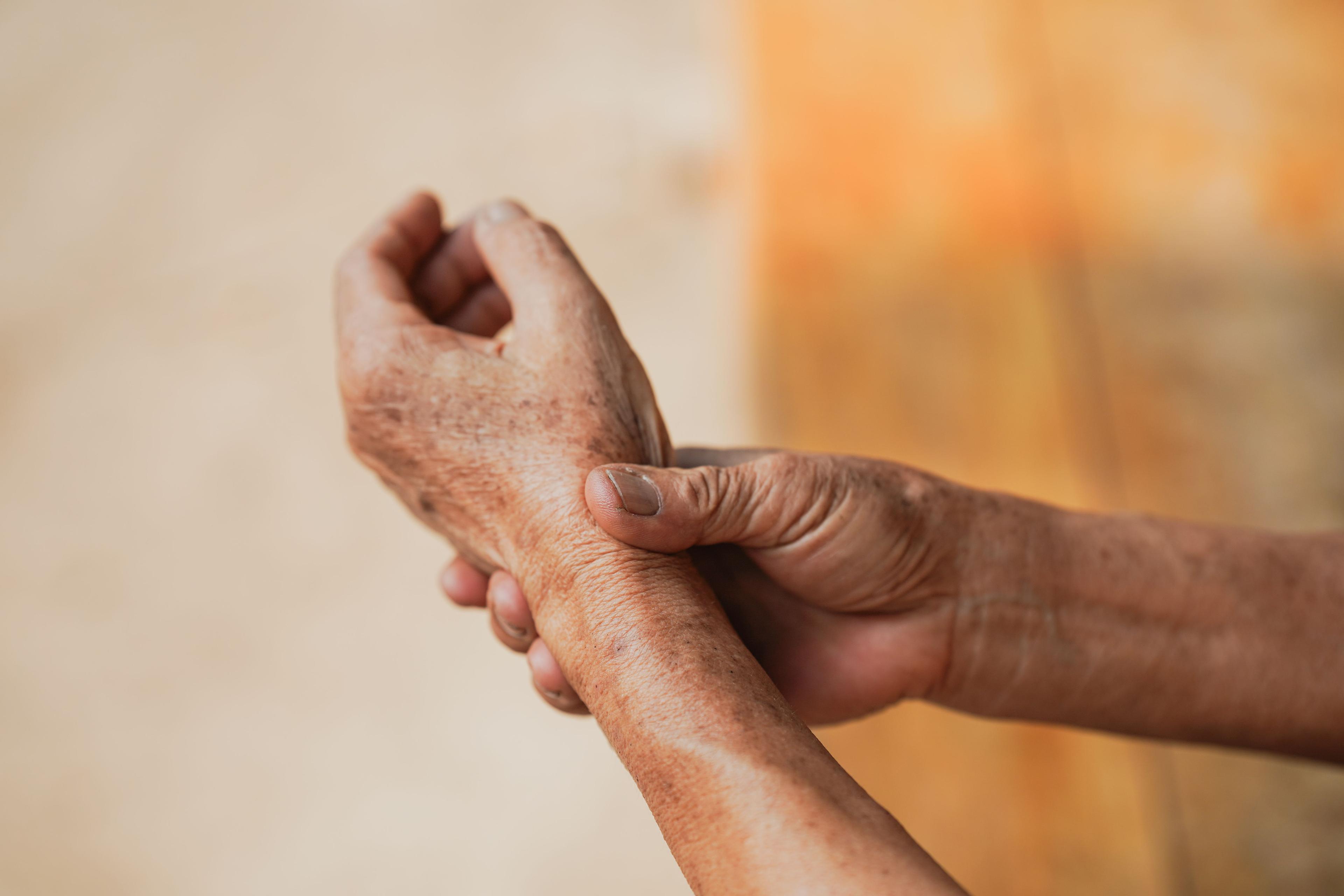 Patient with psoriatic arthritis | Image Credit: © Oporty786 - stock.adobe.com