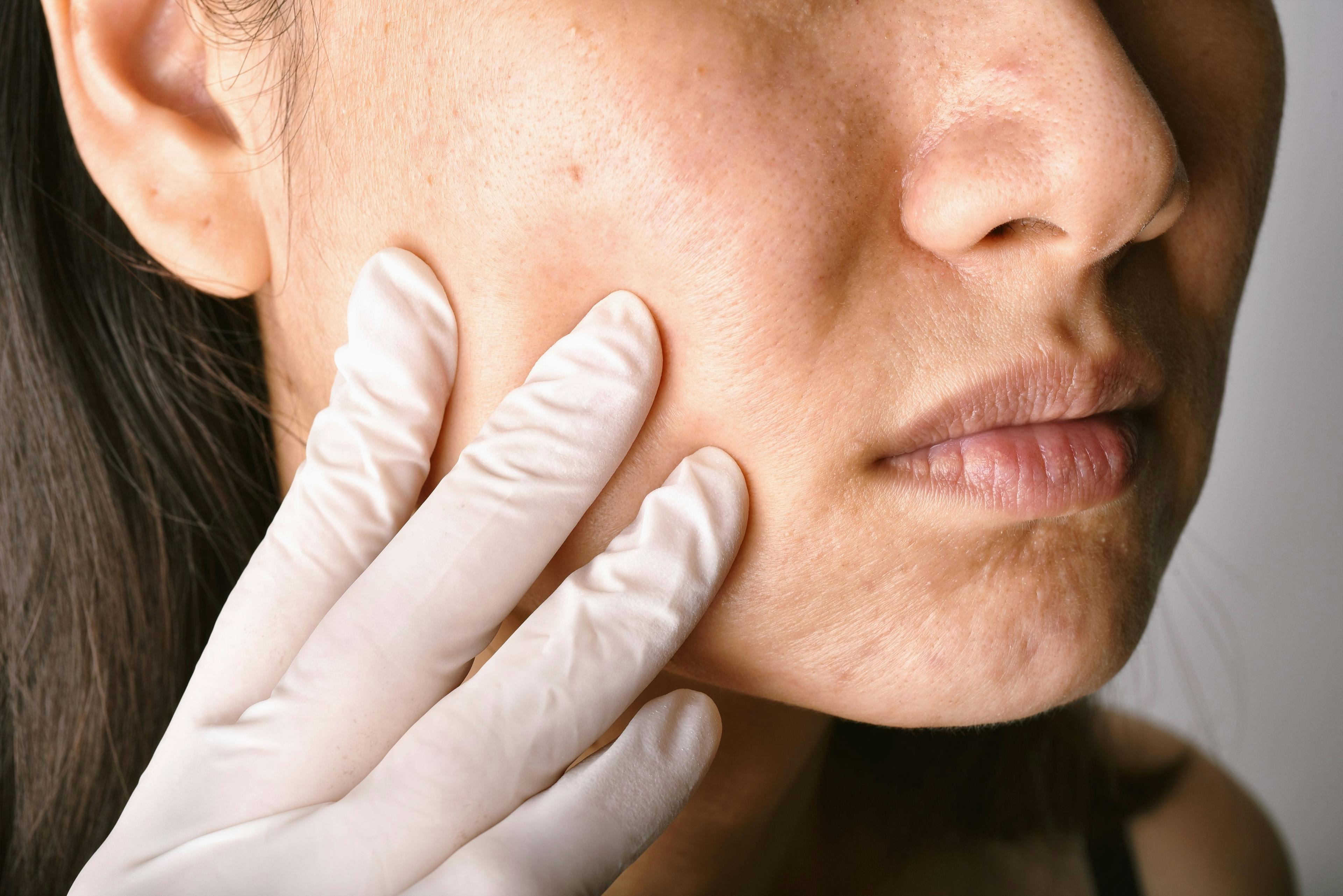 Doctor examining patient's face | Image Credit: © ARTFULLY-79 - stock.adobe.com