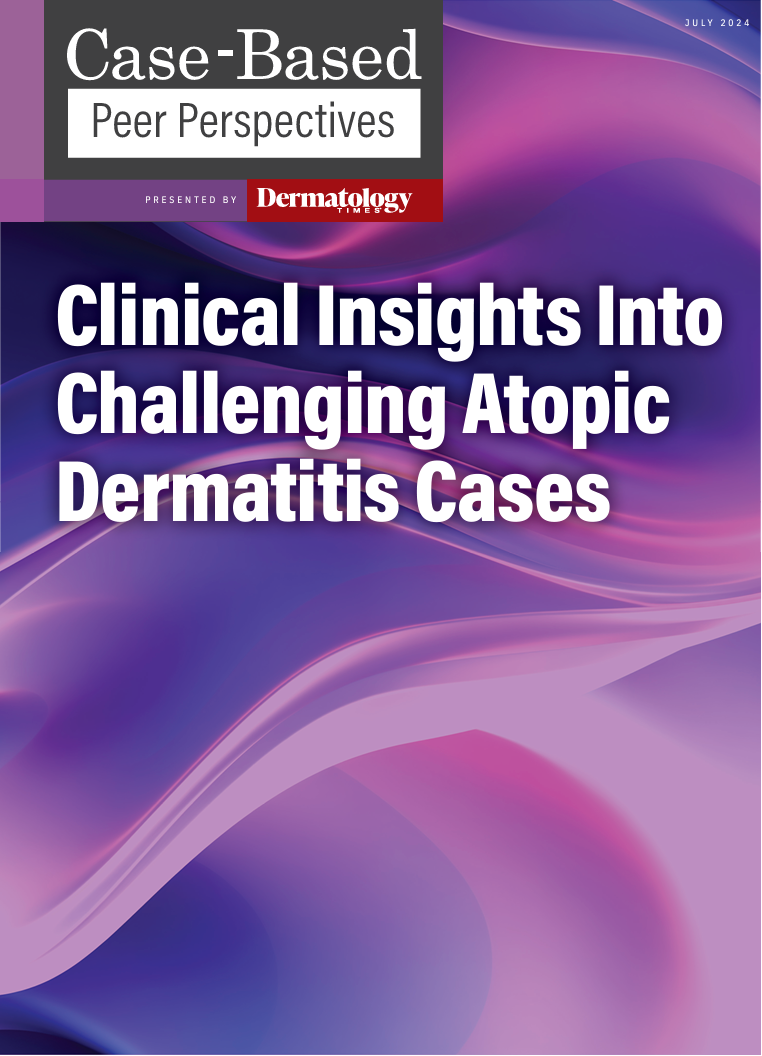 Dermatology Times, Clinical Insights Into Challenging Atopic Dermatitis Cases, July 2024 (Vol. 45. Supp. 04)