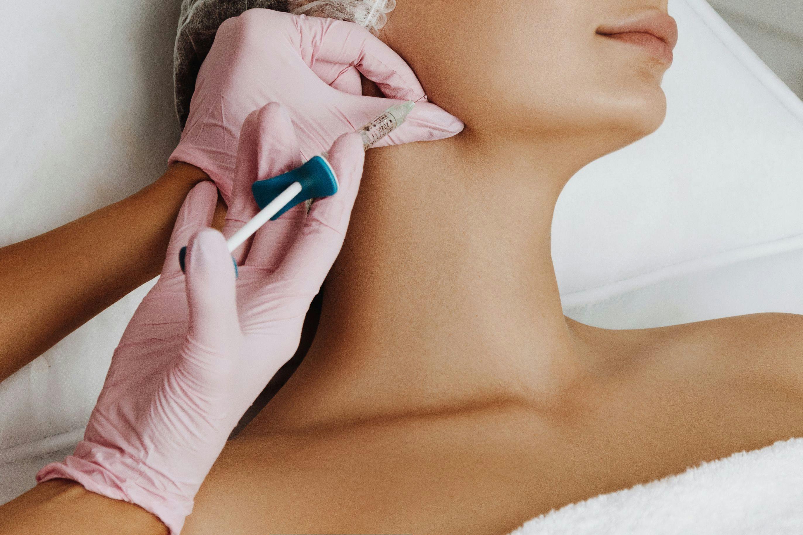 Dermal chin filler injection