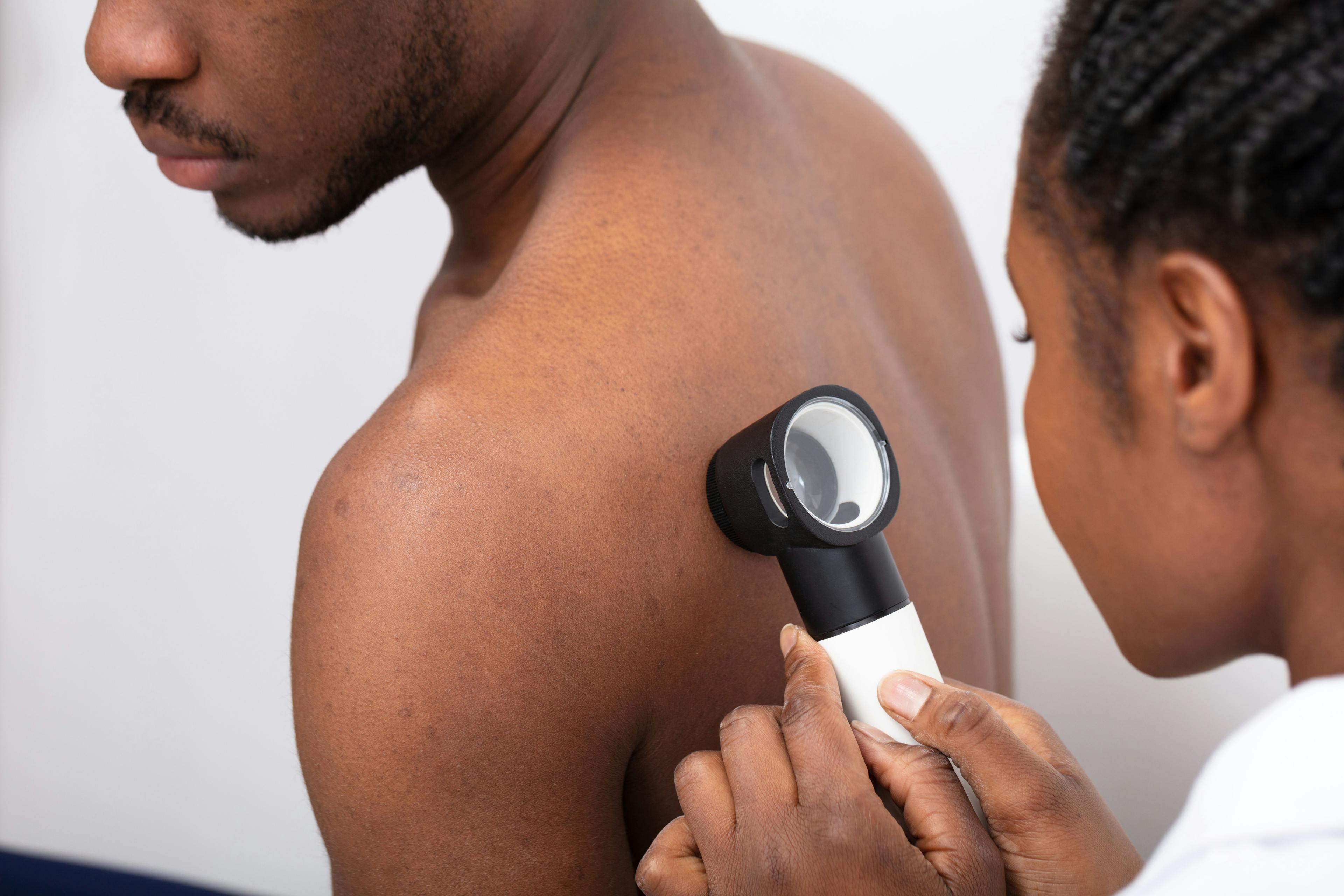 Physician examining patient's skin | Image Credit: © Andrey Popov - stock.adobe.com