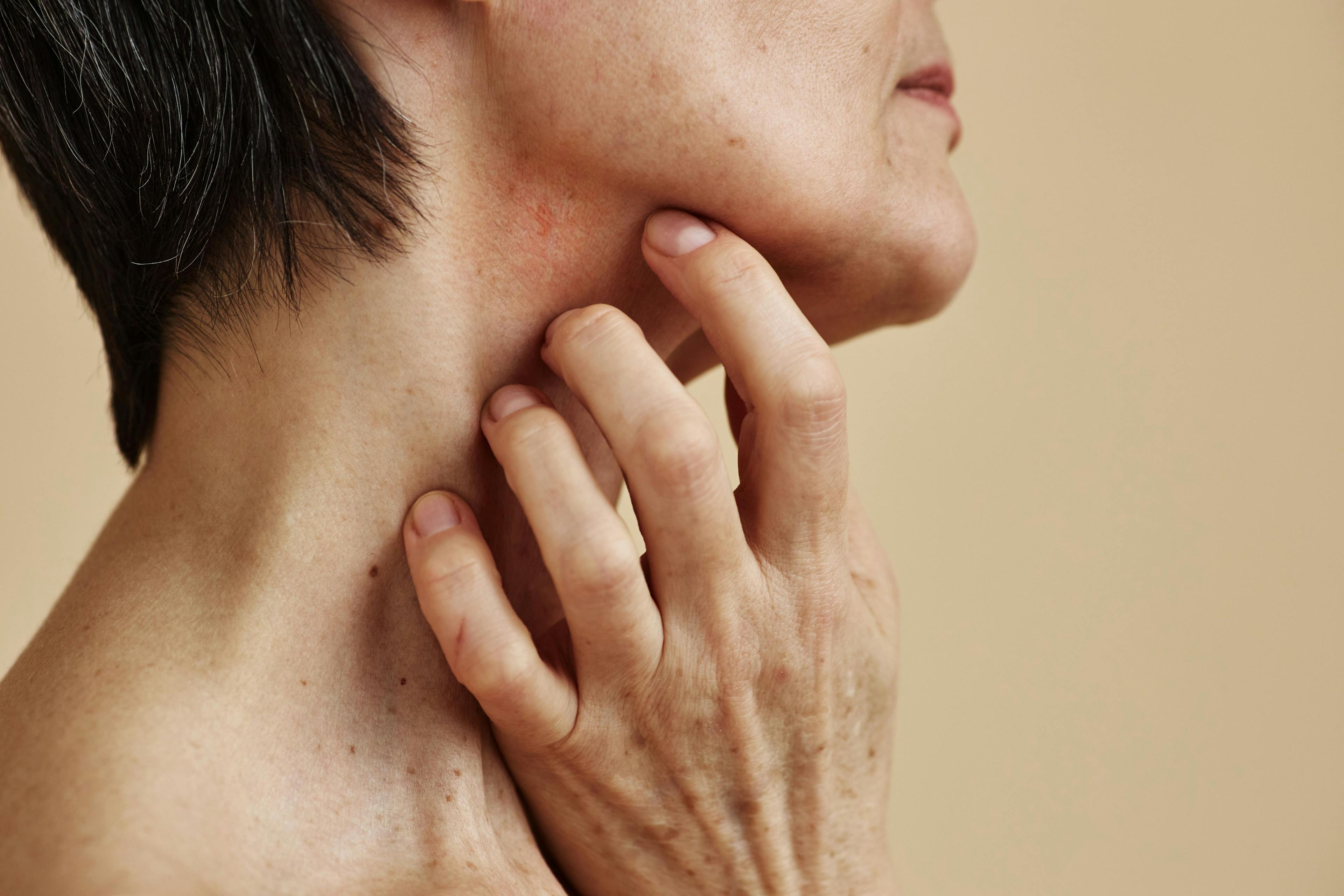 Older woman with short hair scratching neck